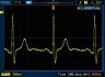 .AVR_DDS_ECG.JPG AVR单片机的DDS信号发生器V2.0-正弦波-方波-锯-三角形-心电图和